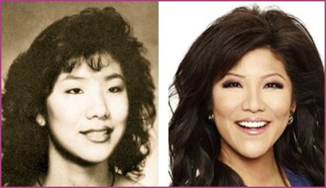 Did the Big Brother Host Undergo Procedures Other Than Double Eyelid Surgery?