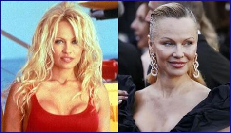 Why Does The Baywatch Star Look Unrecognizable These Days? The Actress Then and Now!